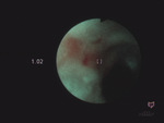 Small ryc 1 opt