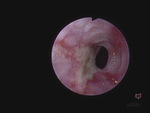 Small ryc 2 opt