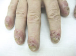 Small rycina 2 opt