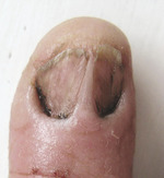 Small rycina 4 skrzydlik (pt opt
