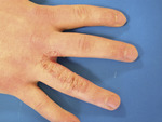 Small fot 1 opt