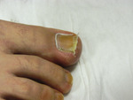Small fot 2 opt