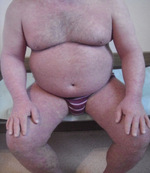 Small foto 1 opt
