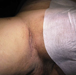 Small fot 04 opt