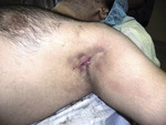 Small fot 05 opt