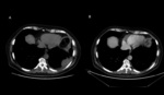 Small ryc 05 opt