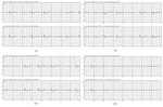 Small 9 opt