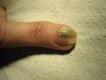 Small pseudomonas opt