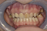 Small 06 opt