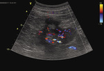 Small ryc 1 opt