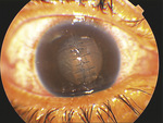 Small ryc 4 opt