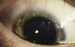Small ryc 5 opt