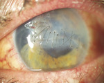 Small ryc 8 opt