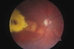 Small ryc 1 opt