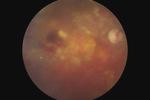 Small ryc 10 1 opt