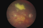 Small ryc 11 opt