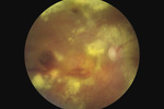 Small ryc 2 1 opt
