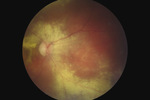 Small ryc 3 1 opt