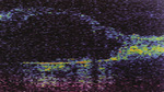 Small ryc 7 1 opt
