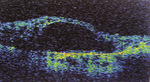 Small ryc 8 1 opt