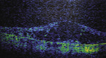 Small ryc 9 1 opt