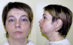 Small 16b opt