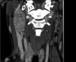 Small ryc 1 opt