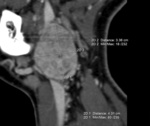 Small ryc 2 opt