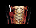 Small ryc 3 opt