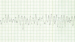 Small rycina 1 vf opt
