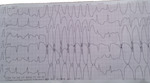 Small rycina 2 vt cmp opt