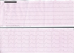 Small rycina 3 af opt