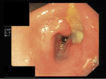 Small ploccek 1 opt