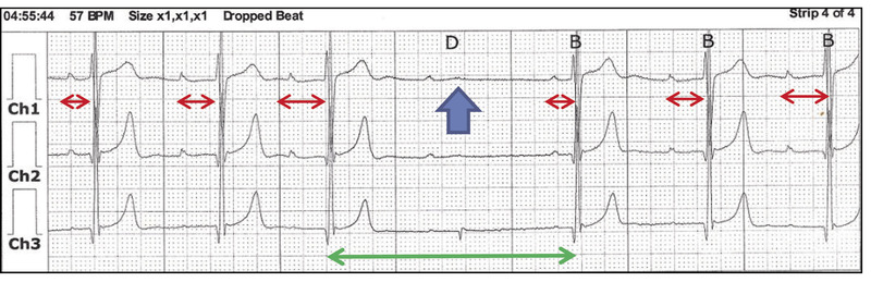 Medium ekg  urba%c5%84ska same ryc opt
