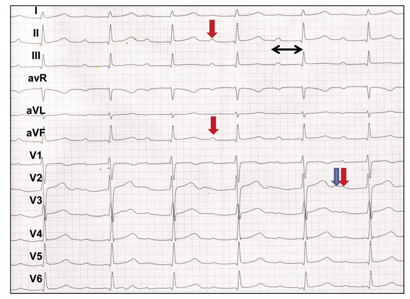 Medium ekg  urba%c5%84ska same ry opt1