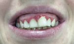 Small image001 opt