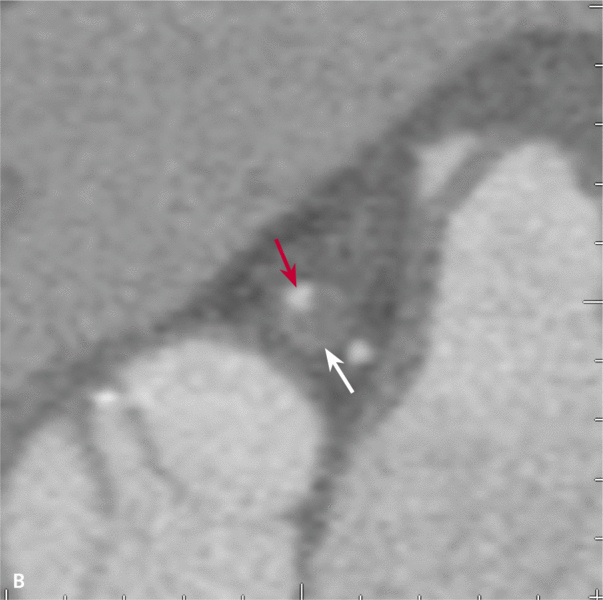 Medium ryc.1b