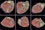 Small ryc.6a f