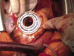 Small ryc 2 opt