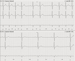 Small 5 opt