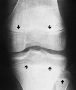 Small image001 opt