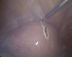 Small 2 opt