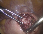 Small 3 opt