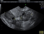 Small image16 opt