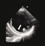 Small 1a opt