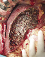 Small ryc 1 1 opt