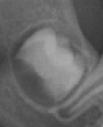 Small 4 opt