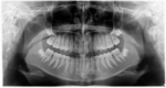 Small image004 opt