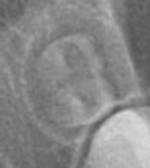 Small 3 opt