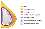Small ryc 1 opt